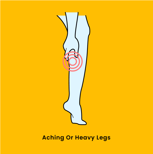 aching or heavy legs diagram